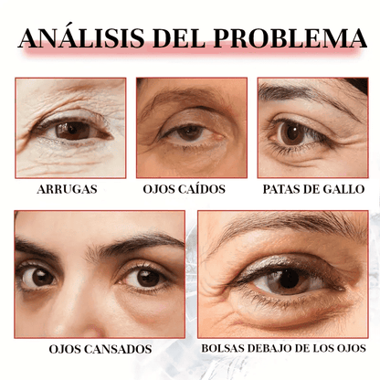 OFERTA 2x1 - Enhancing Eye™ - Tratamiento Dermatológico Natural para Ojos Sin Ojeras, Bolsas ni Párpados CaídosSin Ojeras, Bolsas ni Párpados Caídos